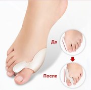 Фиксатор для косточки на ноге Valgus Plus c 50% скидкой!      